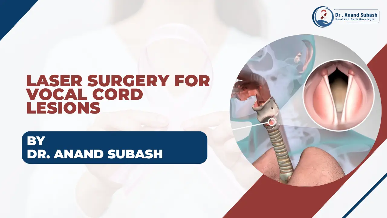 Laser Surgery for Vocal Cord Lesions